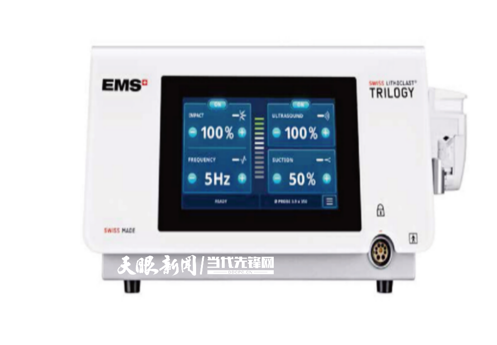 泌尿系统结石患者福音:贵州有了最新一代微创“碎石机”(图1)