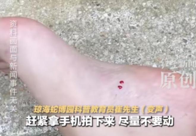 游客蛇伤致死后续！医院迷惑操作家属接连发声已成立调查组(图16)